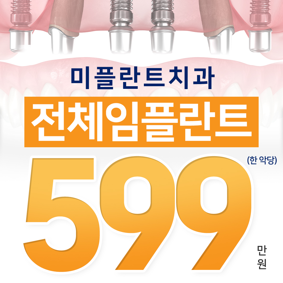 전체임플란트 이벤트